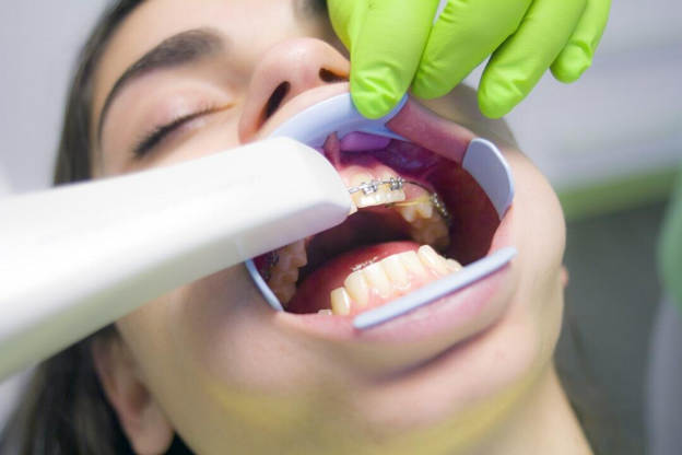 Straightening Your Teeth - dental braces cleaning