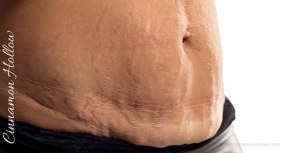 loose skin