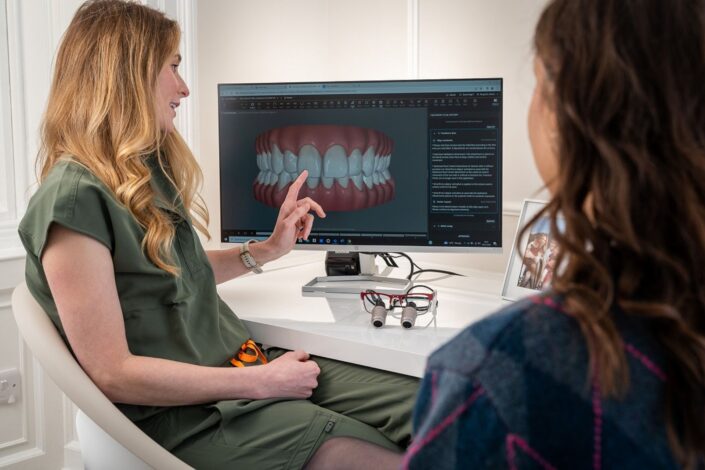 full arch dental implants